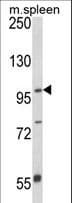 Polyclonal Rabbit anti-Human ANO5 / Anoctamin 5 Antibody (aa792-819, IHC, WB)
