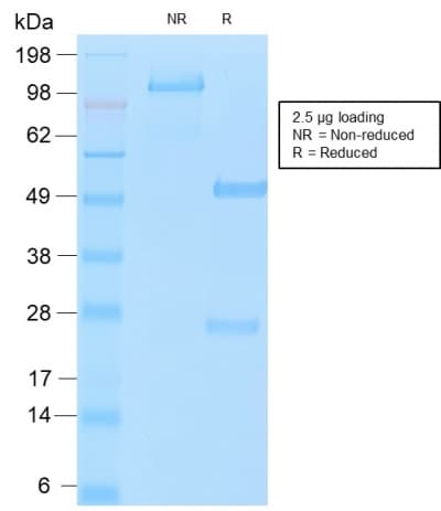 CA125 Antibody (clone OCA125/2349R)