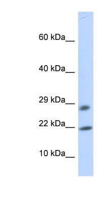 OCIAD2 Antibody (aa72-121)