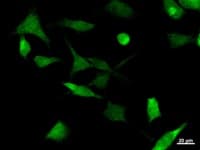 UBP1 Antibody (clone 327C1a)