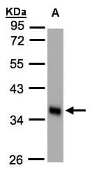 Polyclonal Rabbit anti-Human Scramblase / PLSCR1 Antibody (aa1-286, IHC, WB)