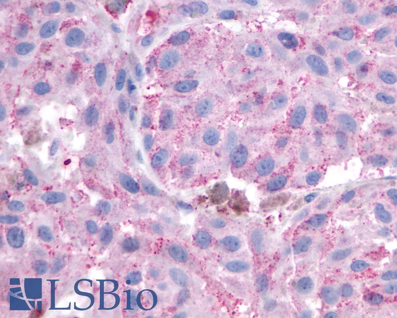 PathPlus™ Polyclonal Rabbit anti-Human HTR7 / 5HT7 Receptor Antibody (C-Terminus, IHC)