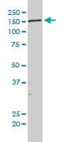 Monoclonal Mouse anti-Human NCAPD3 / HCAP-D3 Antibody (clone 1D5, WB)