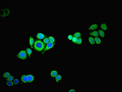 TROVE2 Antibody