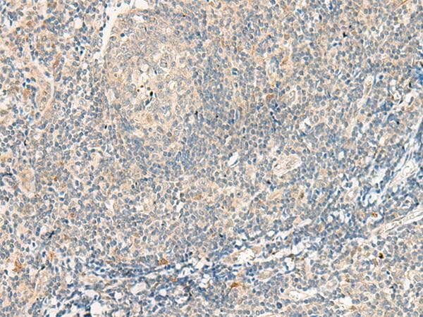 GPR75 Antibody