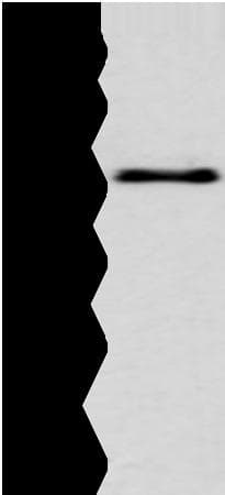 EPHA3 / EPH Receptor A3 Antibody
