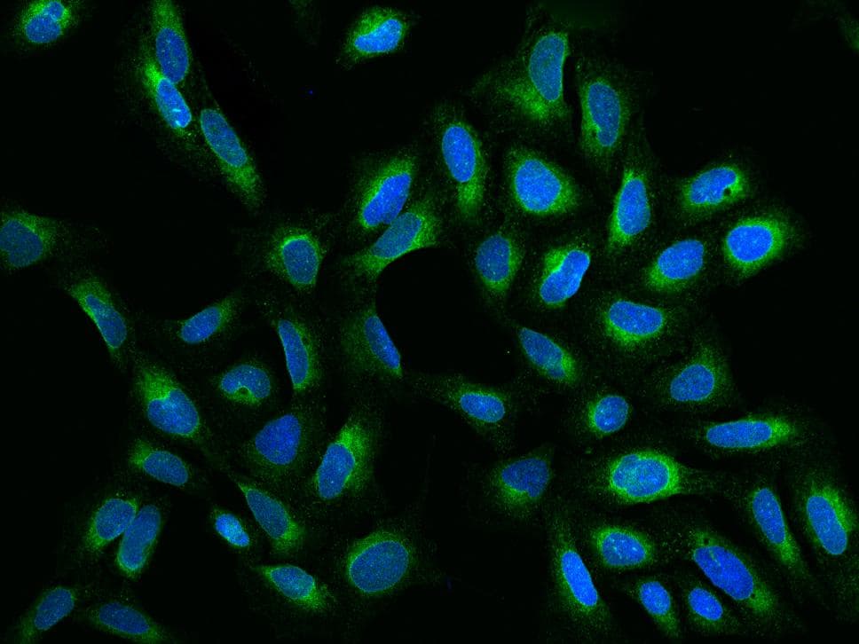 HELO1 / ELOVL5 Antibody
