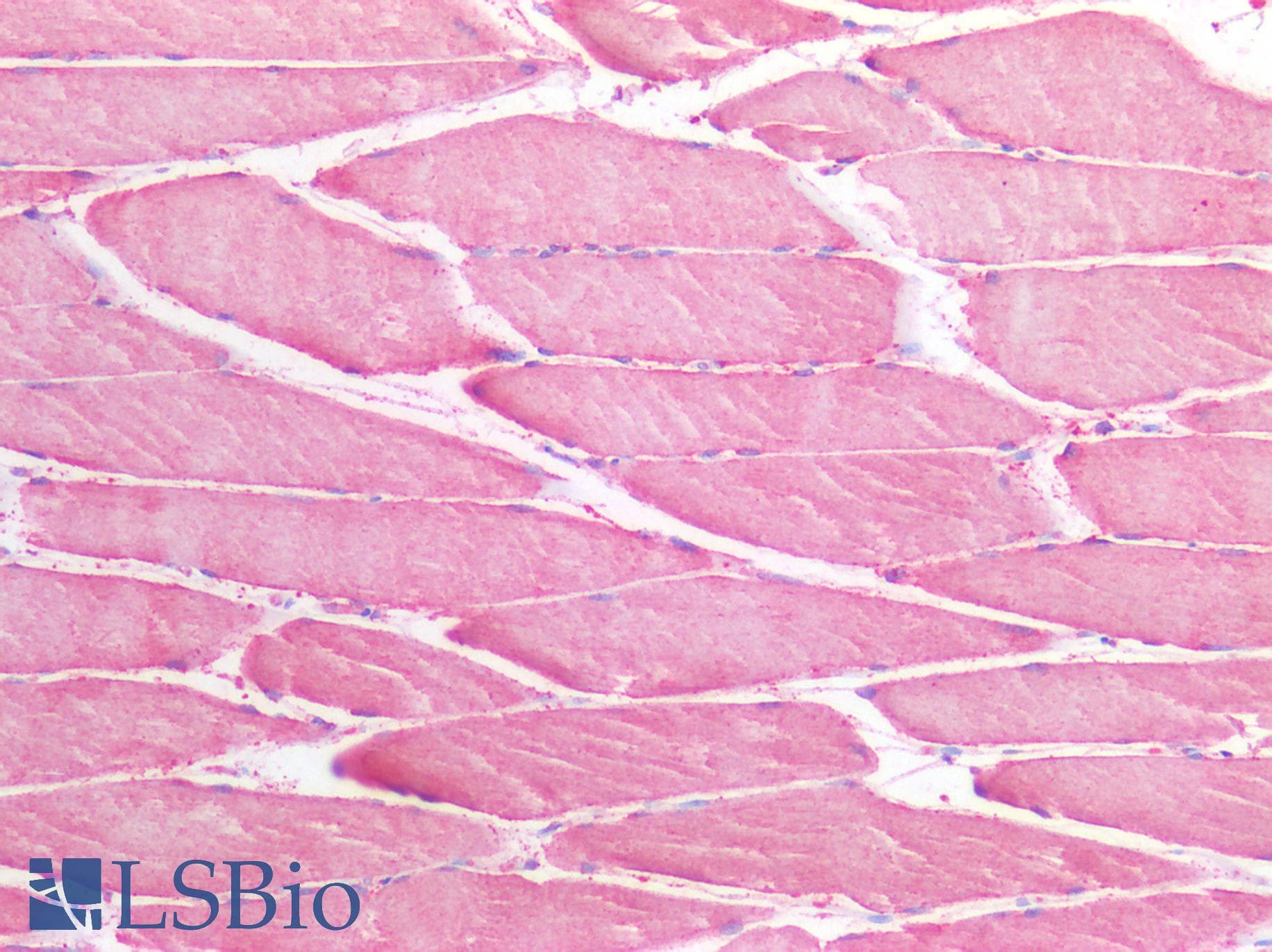 PathPlus™ SLC6A8 Antibody (aa212-226)