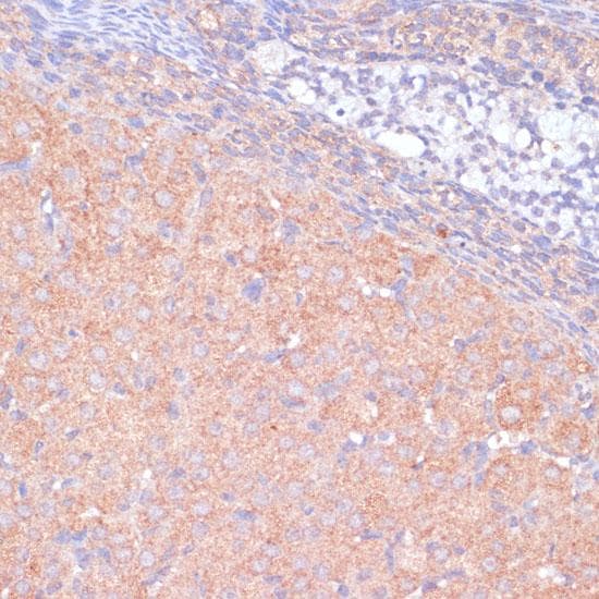 KANK2 Antibody