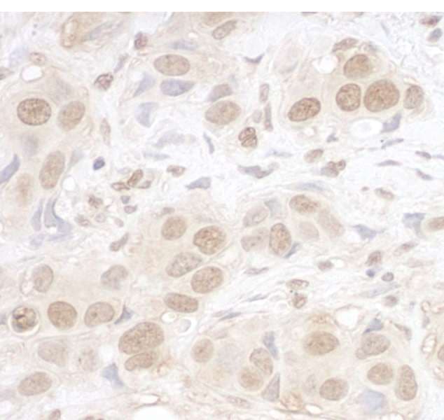 ARID3B Antibody (aa100-150)