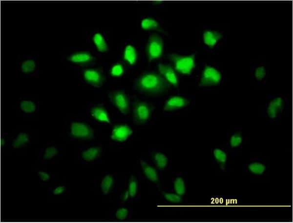 IHC-plus™ Monoclonal Mouse anti-Human MSI1 / Musashi 1 Antibody (clone 3F2, IHC, IF, WB)