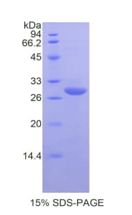 Mouse CD55 Protein (Recombinant His)