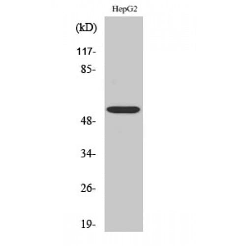 ALDH1B1 Antibody (280-360 aa, Internal)