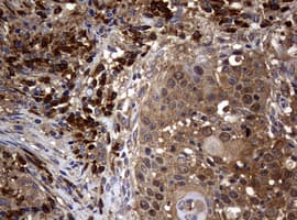 NME1 / NM23 Antibody (clone OTI7E5)