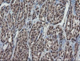ESRRG / ERR Gamma Antibody (aa24-263, clone OTI1E5)
