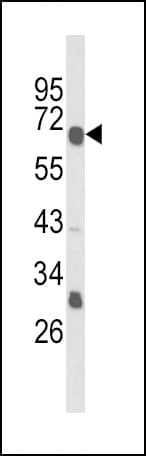 GIPR / GIP Receptor Antibody (aa104-136)