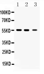 Polyclonal Rabbit anti-Human TUBB / Beta Tubulin Antibody (IHC, WB)