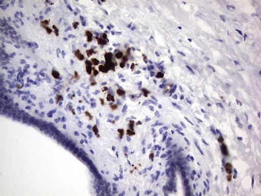S100A9 / MRP14 Antibody (clone OTI8G1)