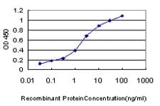IHC-plus™ TNNC1 / Cardiac Troponin C Antibody (clone 1F8-A9)