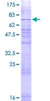 Human MMD2 Protein (Recombinant GST)