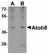 Polyclonal Rabbit anti-Human ATOH8 Antibody (IHC, WB)