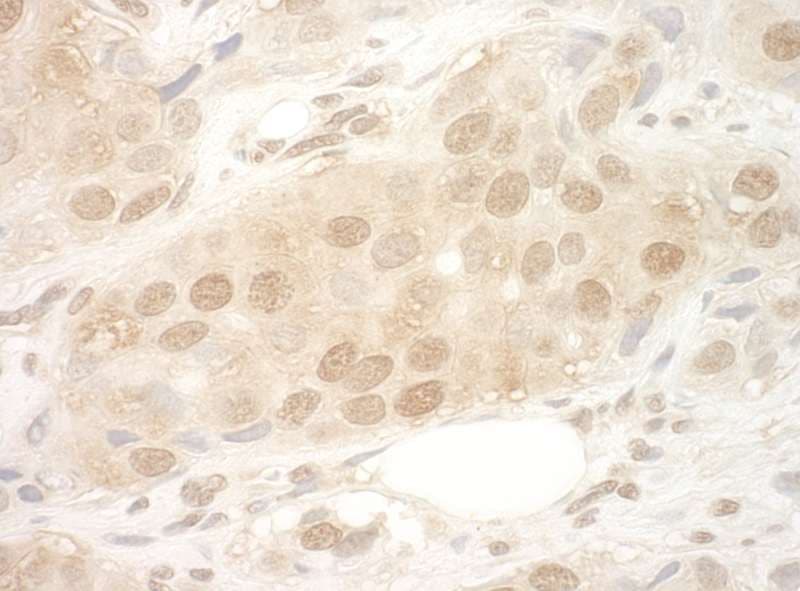 EIF2B5 Antibody (aa550-600)