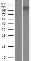 Human ZNF827 Protein (Over-Expression Lysate Myc-DDK (Flag))