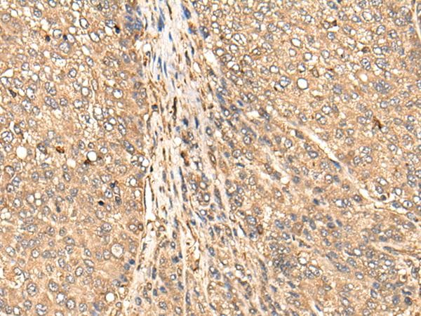 Polyclonal Rabbit anti-Human BAIAP2L1 Antibody (IHC, WB)
