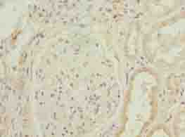 Polyclonal Rabbit anti-Human TMEM154 Antibody (IHC, WB)