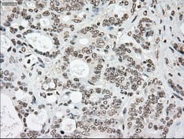 SSB / La Antibody (clone OTI2C8)