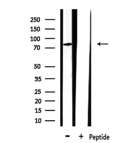 Polyclonal Rabbit anti-Human ClC-3 / CLCN3 Antibody (IHC, WB)