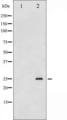 Polyclonal Rabbit anti-Human TK1 / TK / Thymidine Kinase Antibody (phospho-Ser13, IHC, IF, WB)