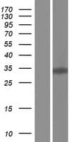 KLF6 Protein (Over-Expression Lysate Myc-DDK (Flag))