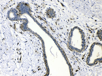 VASP Antibody