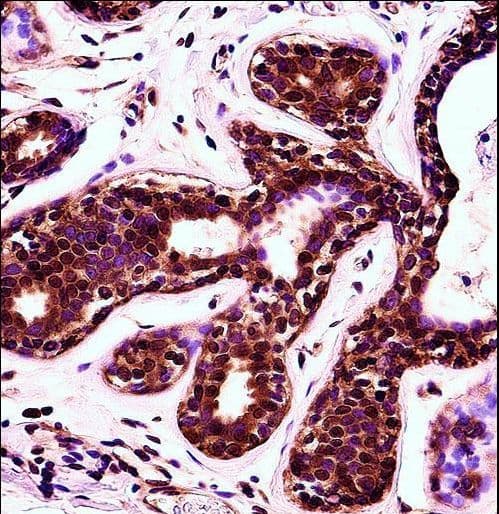 PDCD4 Antibody (aa121-149)
