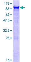 Human PAPSS2 Protein (Recombinant GST)