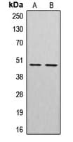 Polyclonal Rabbit anti-Human CTSE / Cathepsin E Antibody (Internal, IHC, WB)