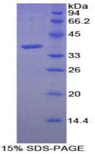 Human Calcineurin Protein (Recombinant His-T7)
