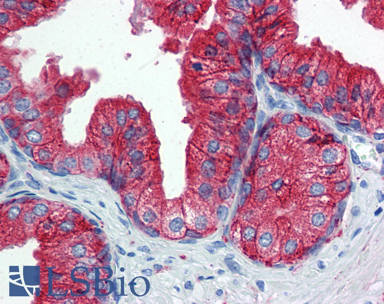 IHC-plus™ CD9 Antibody (clone MM2/57)