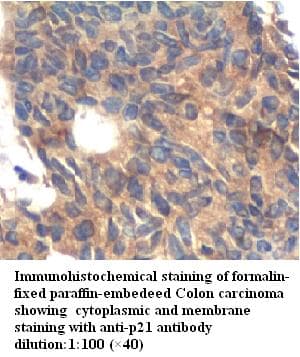 CDKN1A / WAF1 / p21 Antibody
