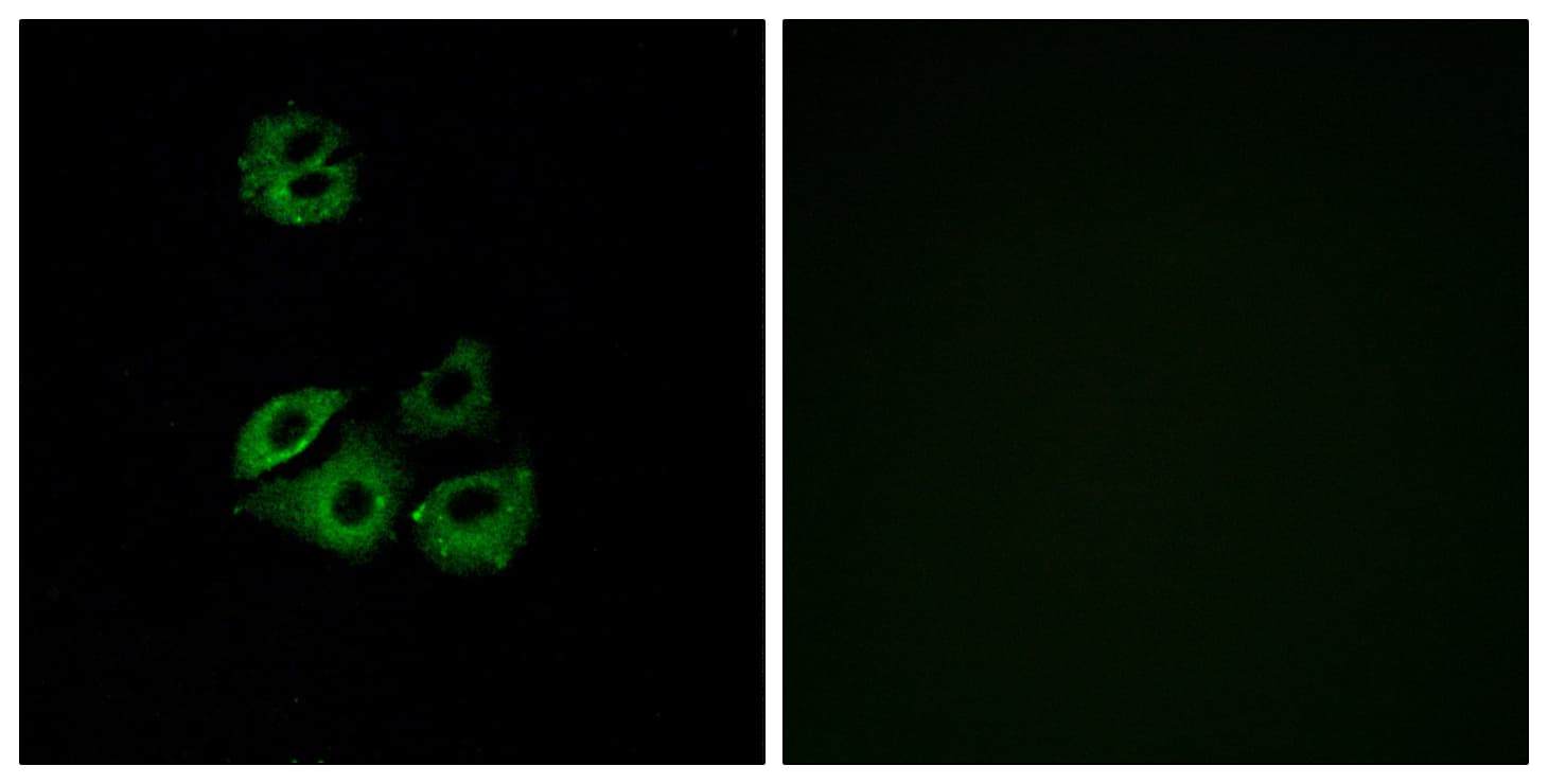 ACKR2 / CCR10 / D6 Antibody (aa335-384)