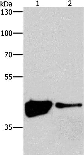 MAPK11 / SAPK2 / p38 Beta Antibody