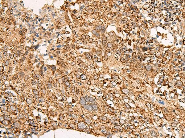 Polyclonal Rabbit anti-Human ATP5I Antibody (IHC, WB)