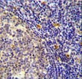 YDJC Antibody (aa169-198)