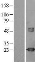 VILIP / VSNL1 Protein (Over-Expression Lysate Myc-DDK (Flag))