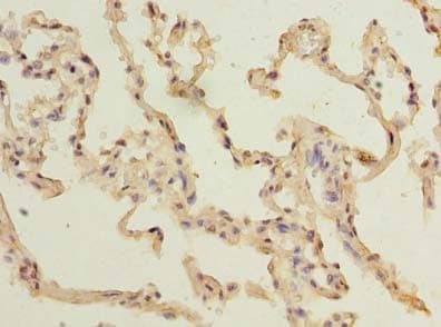 TM4SF1 Antibody