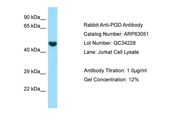 PGD Antibody (aa83-132)