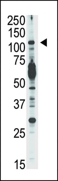 PIK3CD / PI3K Delta Antibody (aa687-717)
