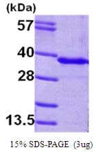 Human GNMT Protein (Recombinant His)