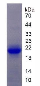 Rat IL1R1 Protein (Recombinant His, N-Terminal)